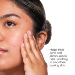 The Acne Set-Regular - Image 4